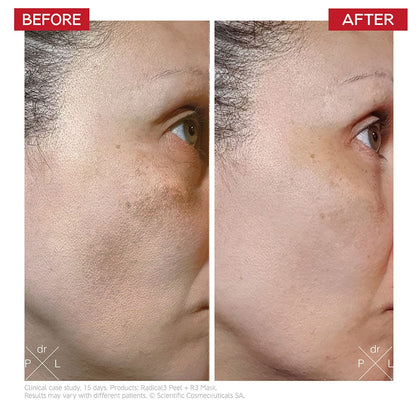 Dr. LEVY Radical3 Reboot Pro Peel (50ml)