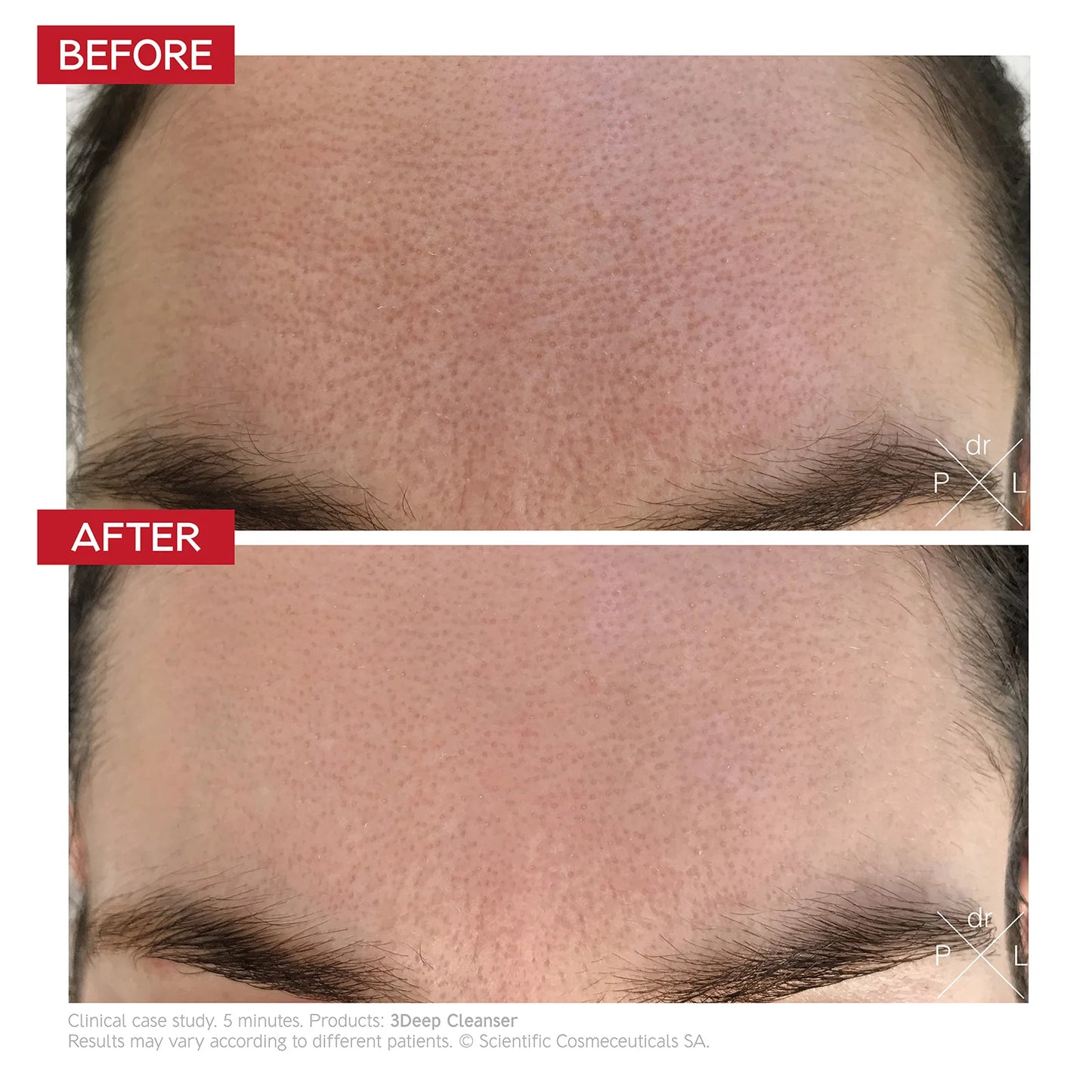 Dr. LEVY 3Deep Cell Renewal Micro-Resurfacing Cleanser (150m)