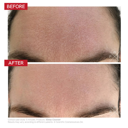 Dr. LEVY 3Deep Cell Renewal Micro-Resurfacing Cleanser (150m)