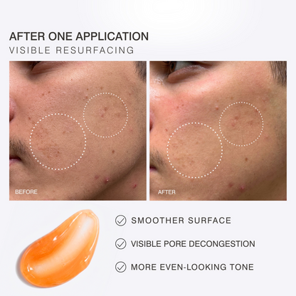 Dr Sebagh Deep Exfoliating Mask (50ml)