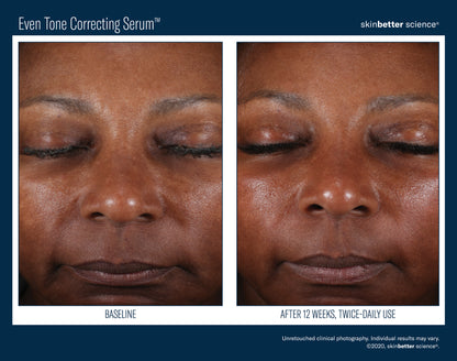 Skinbetter Science Even Tone Correcting Serum (50ml)