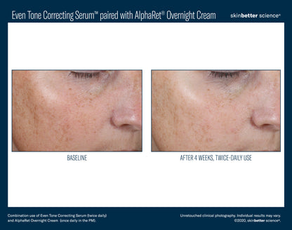 Skinbetter Science Even Tone Correcting Serum (50ml)