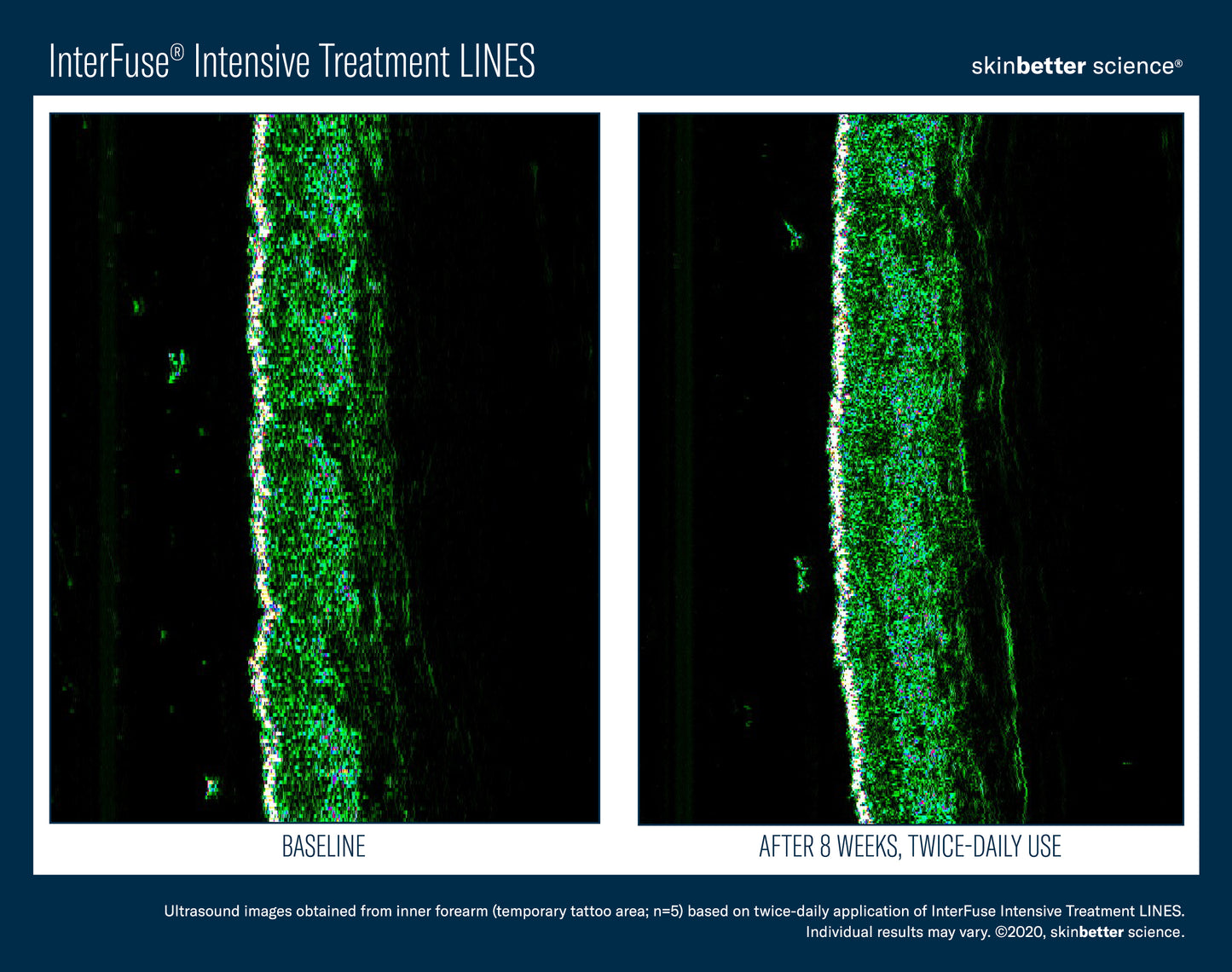 Skinbetter Science InterFuse Intensive Treatment LINES 15ml/30ml