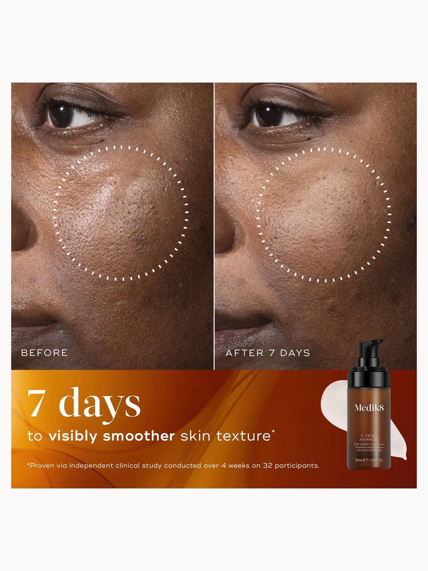 MEDIK8 C-TETRA ADVANCED (30ML)