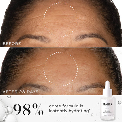 Medik8-liquid-peptides-30ml-beforeand-after-forehead