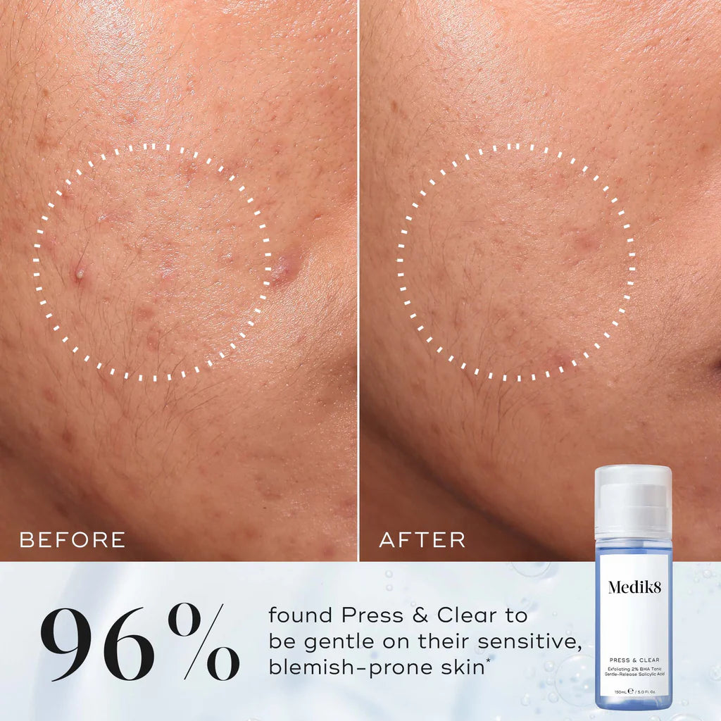 Medik8-press-clear-150ml-beforeand-after