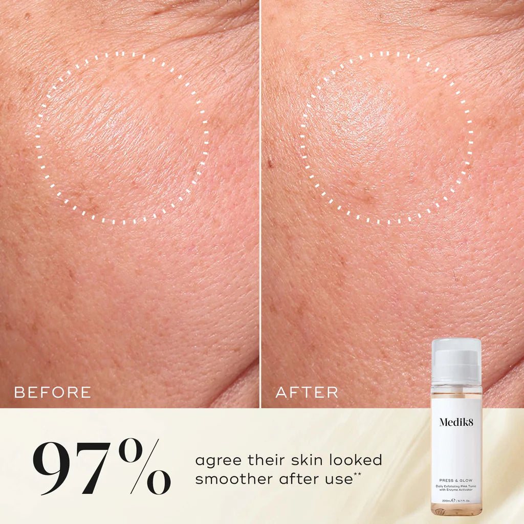 Medik8-press-glow-200ml-beforeand-after