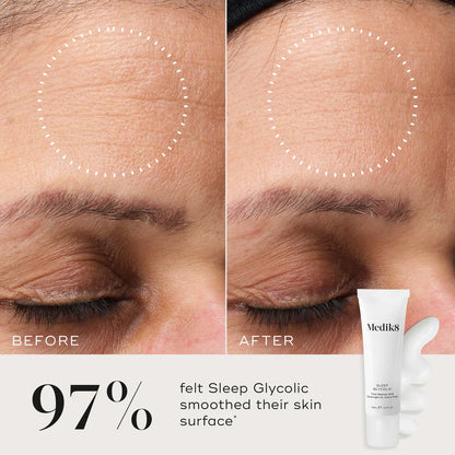 Medik8-sleep-glycolic-30ml-beforeand-after