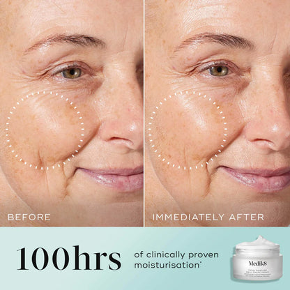 Medik8-total-moisture-daily-facial-cream-50ml-beforeand-after