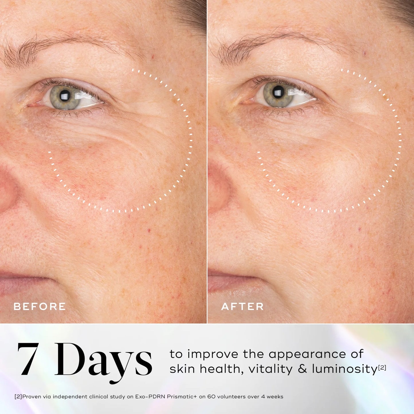 Medik8 Exo-PDRN Prismatic+ Serum (30m)