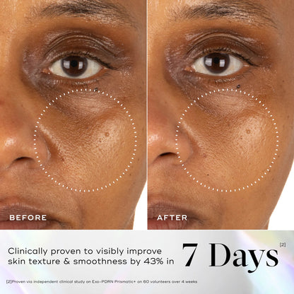 Medik8 Exo-PDRN Prismatic+ Serum (30m)