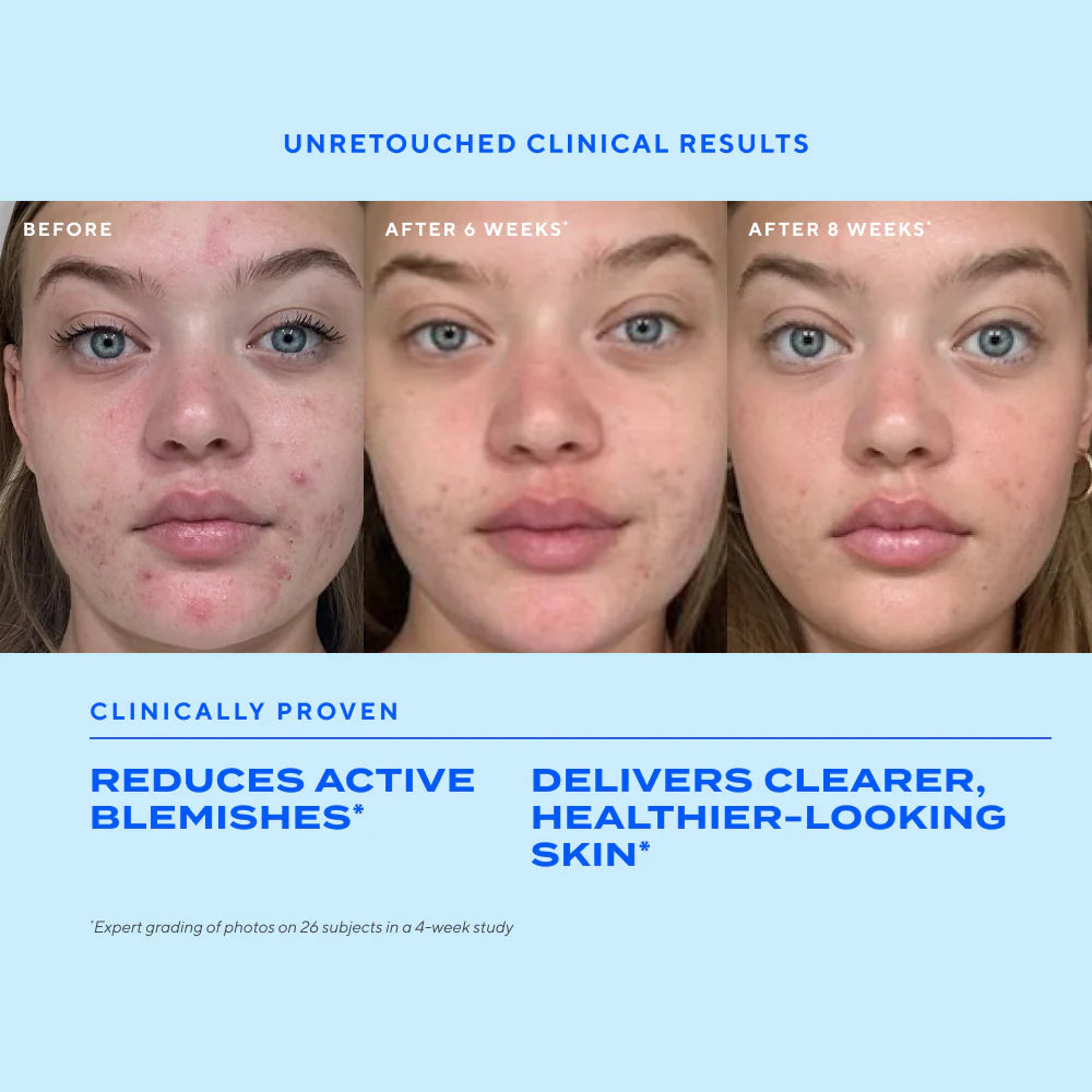 Murad Blemish Control Biome-Balancing Clear & Prevent Blemish Treatment Serum (30ml)