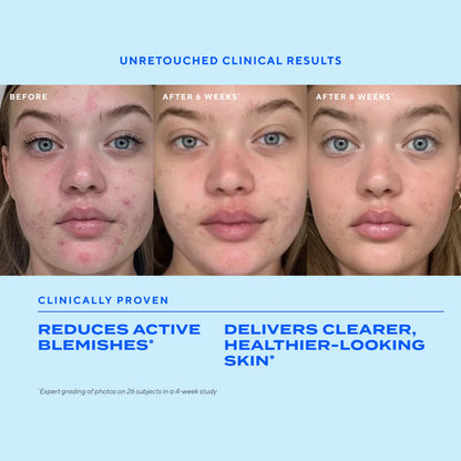 Murad Blemish Control Biome-Balancing Clear & Prevent Blemish Treatment Serum (30ml)