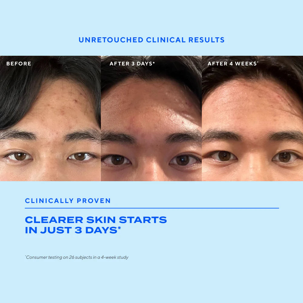 Murad Blemish Control Biome-Balancing Clear & Prevent Blemish Treatment Serum (30ml)