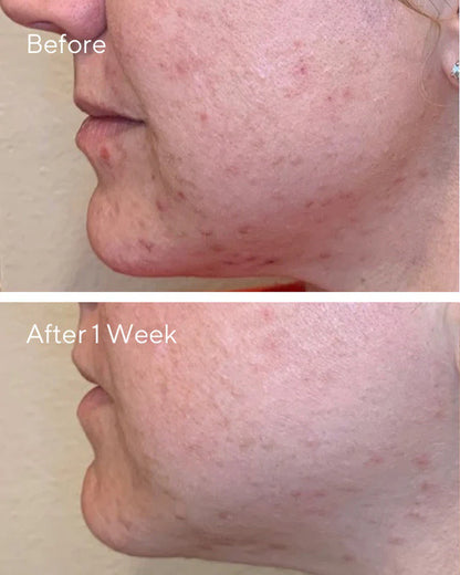 Murad Daily Clarifying Peel (95ml)