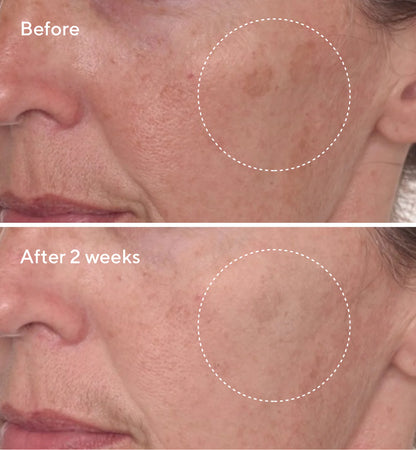 Murad Rapid Dark Spot Correcting Serum (30ml)