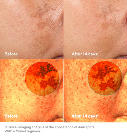 Murad Rapid Dark Spot Correcting Serum (30ml)