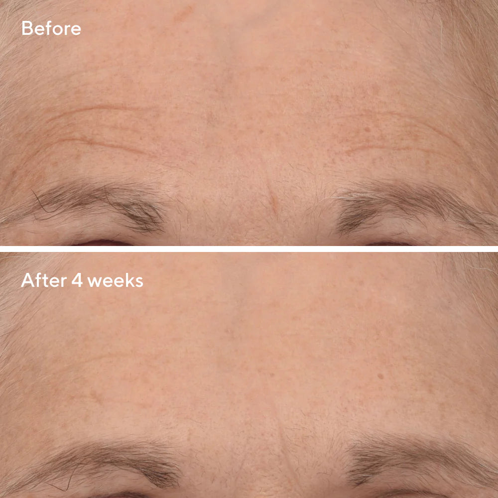Murad Retinal ReSculpt™ Overnight Treatment (30ml)