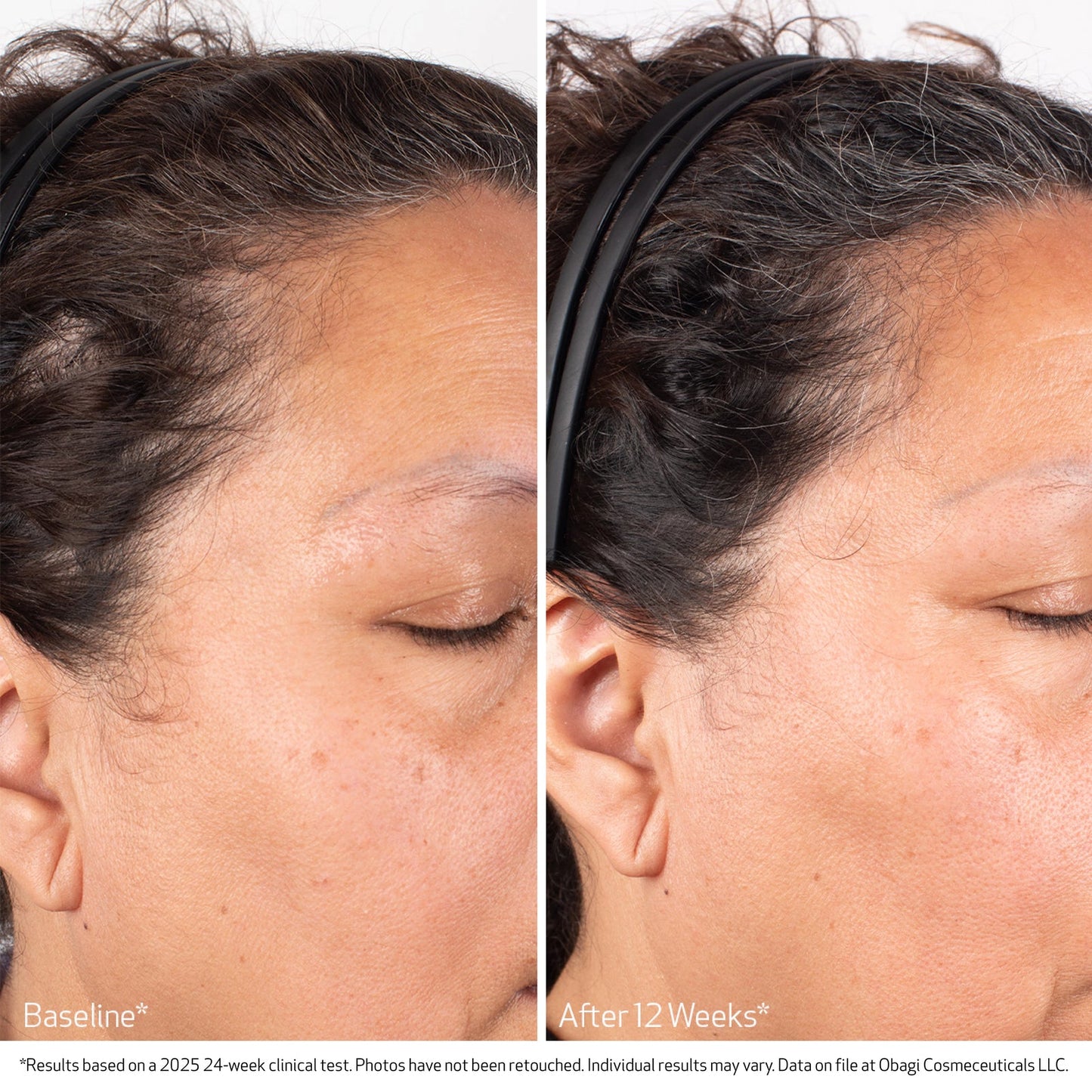 OBAGI® MEDICAL BIOSTIM™ SCALP SERUM (60ML)