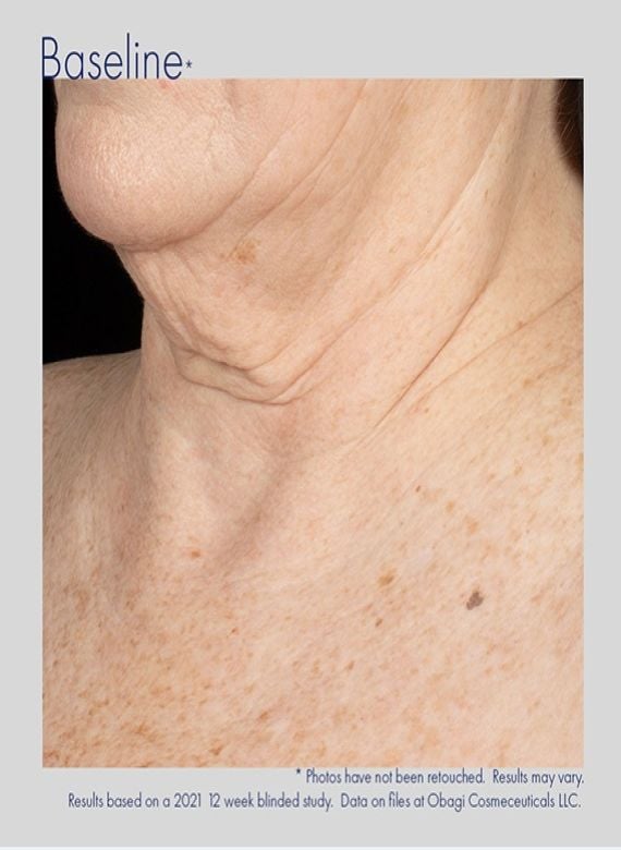 Obagi Elastiderm Neck and Décolleté Concentrate (60ml)