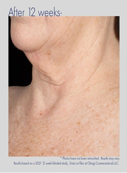 Obagi Elastiderm Neck and Décolleté Concentrate (60ml)