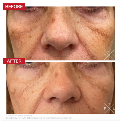 Dr. LEVY Pigment Control Drops (30 ml)