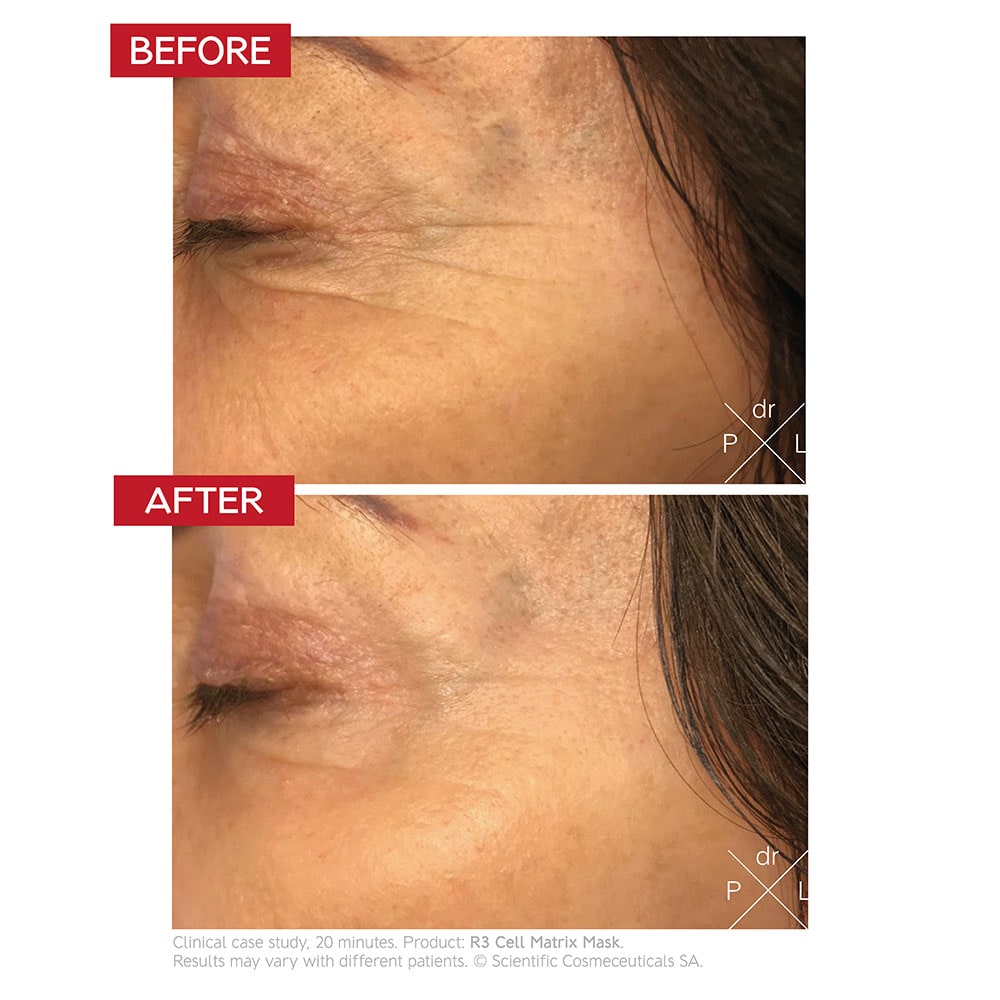Dr. LEVY R3 Cell Matrix Mask (50ml)