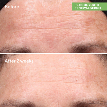 Murad Retinol Youth Renewal Serum (30ml)