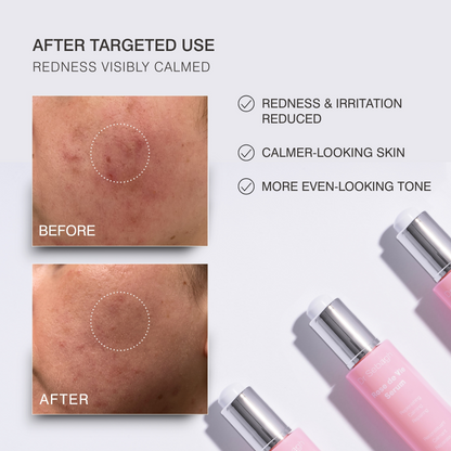 Dr Sebagh Rose de Vie Serum (30ml)