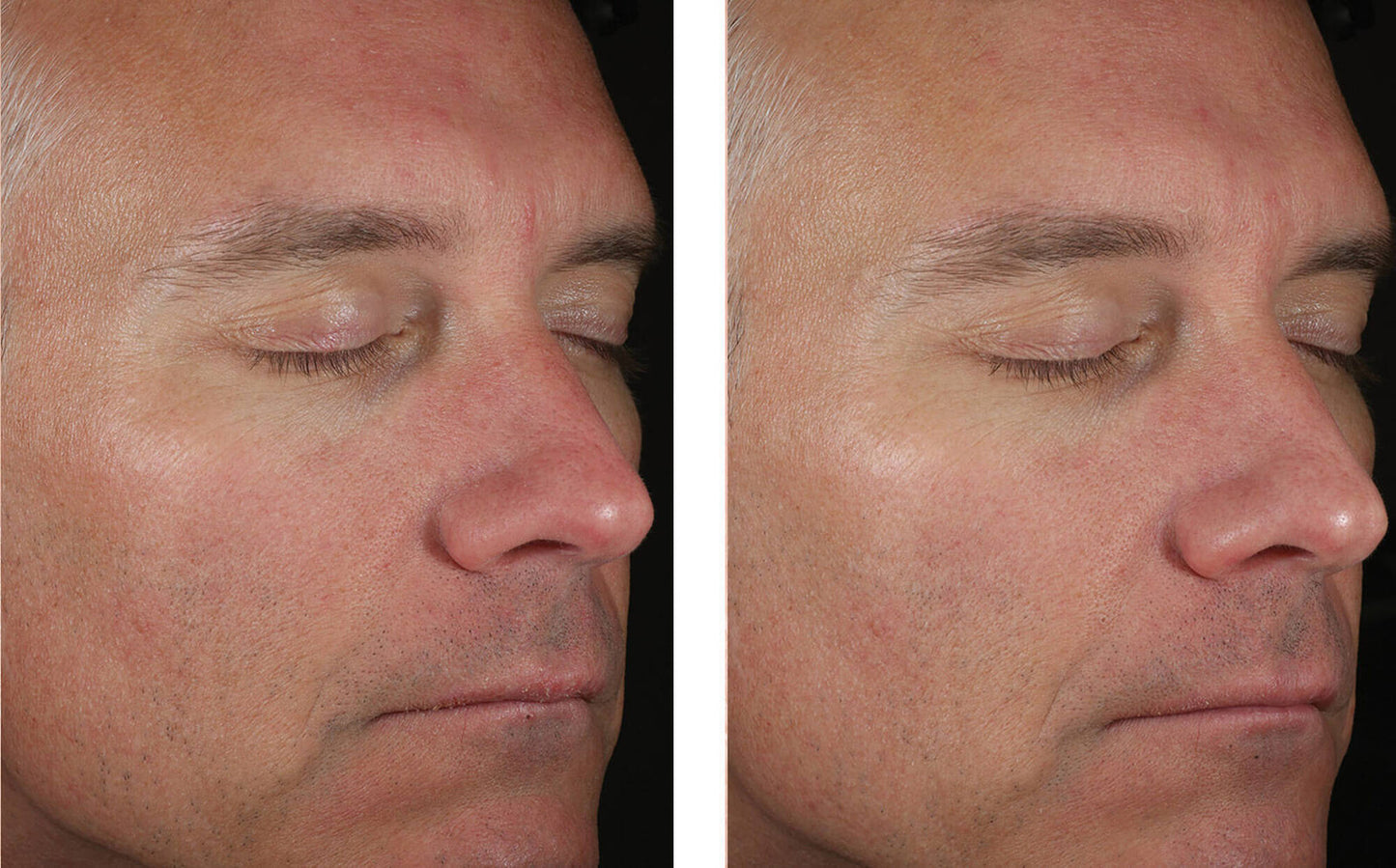 Skinbetter Science Solo Hydrating Defense MEN - (50 ml)