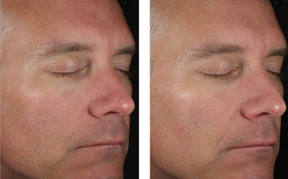 Skinbetter Science Solo Hydrating Defense MEN - (50 ml)