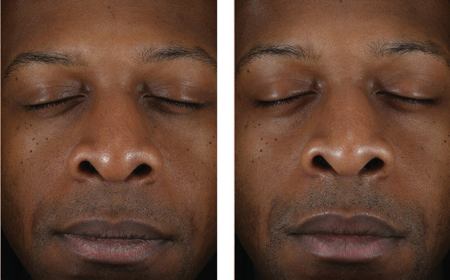 Skinbetter Science Solo Hydrating Defense MEN - (50 ml)