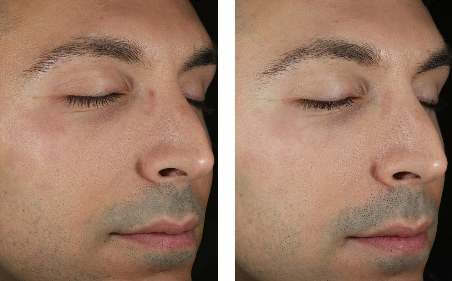 Skinbetter Science Solo Hydrating Defense MEN - (50 ml)