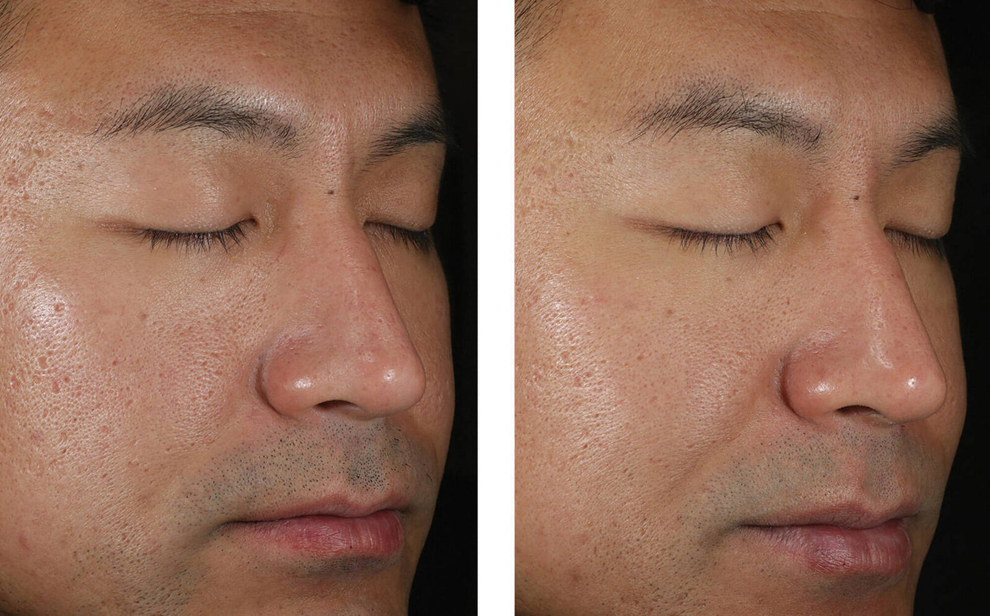 Skinbetter Science Solo Hydrating Defense MEN - (50 ml)