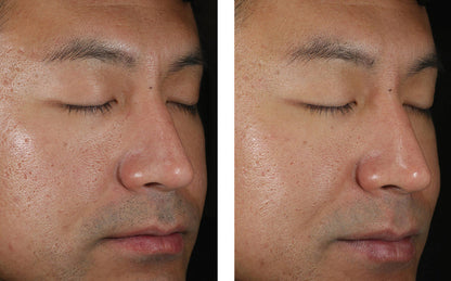 Skinbetter Science Solo Hydrating Defense MEN - (50 ml)