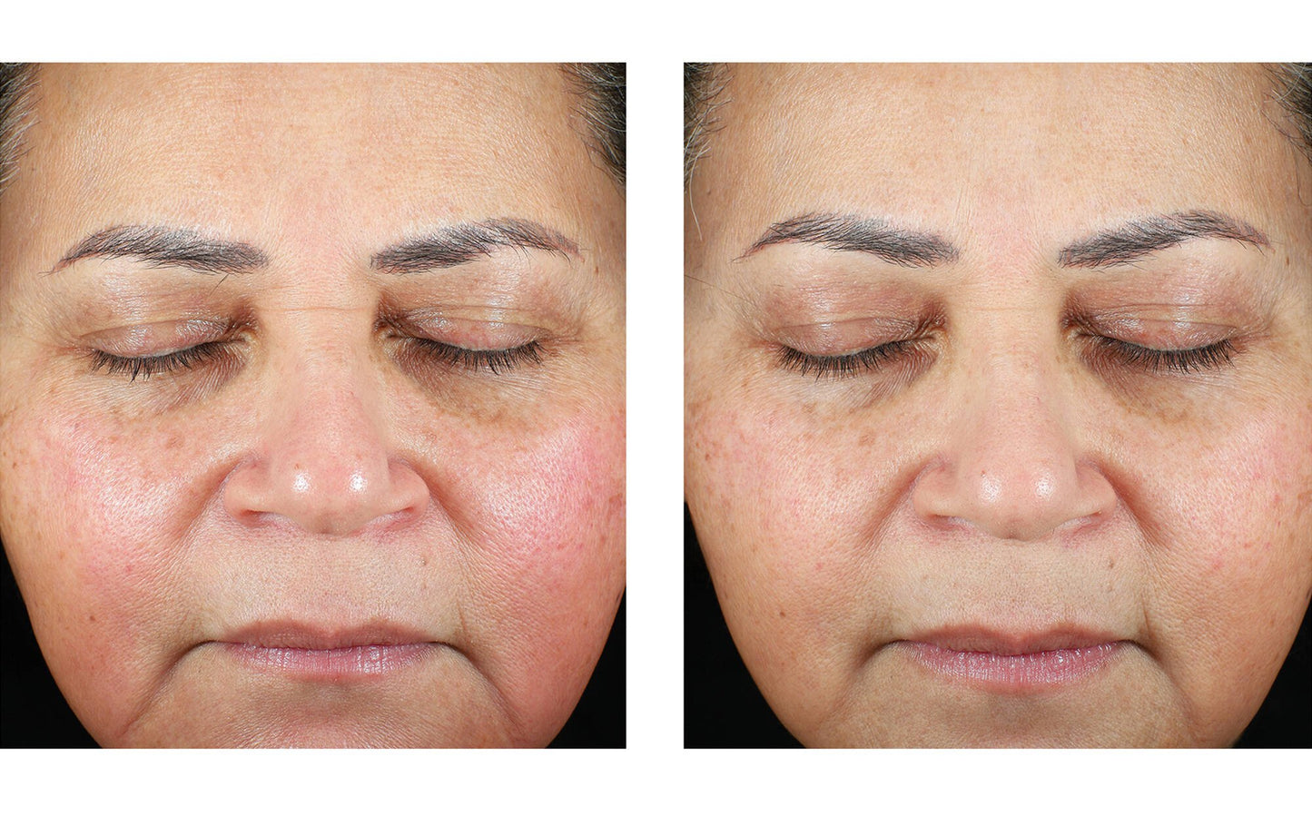 Skinbetter Science Trio Luxe Moisture Treatment – (50 ml)