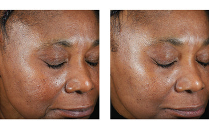 Skinbetter Science Trio Luxe Moisture Treatment – (50 ml)