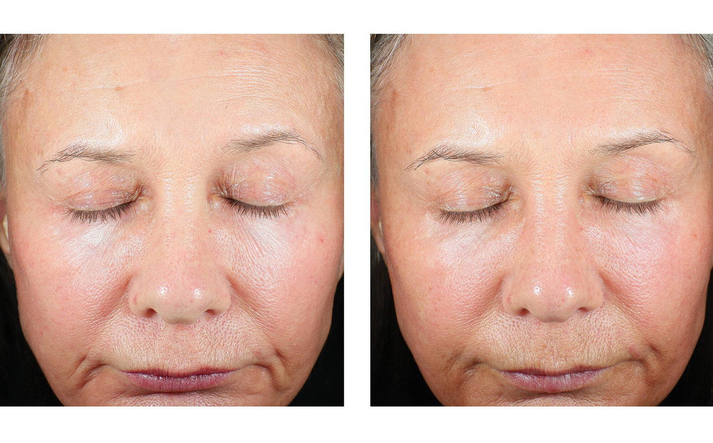 Skinbetter Science Trio Luxe Moisture Treatment – (50 ml)