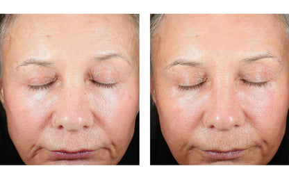 Skinbetter Science Trio Luxe Moisture Treatment – (50 ml)