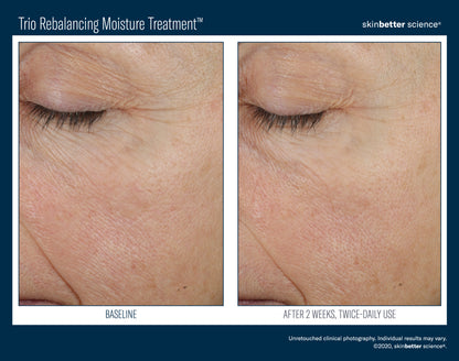 Skinbetter Science Trio Rebalancing Moisture Treatment (50ml)