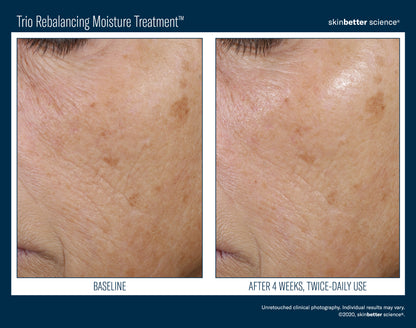 Skinbetter Science Trio Rebalancing Moisture Treatment (50ml)