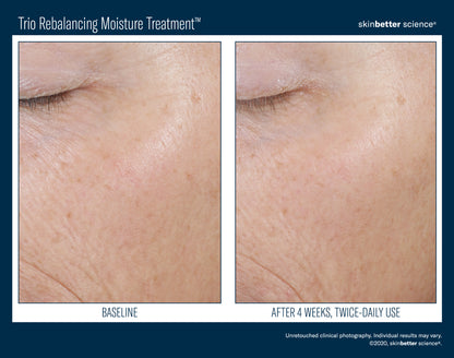 Skinbetter Science Trio Rebalancing Moisture Treatment (50ml)