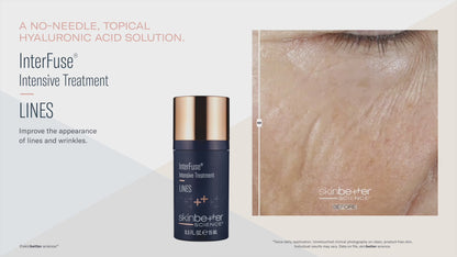 Skinbetter Science InterFuse Intensive Treatment LINES 15ml/30ml