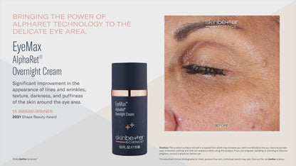 Skinbetter Science EyeMax AlphaRet Overnight Cream (15ml)
