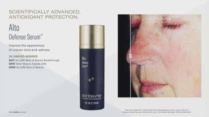 Skinbetter Science Alto Defense Serum (30ml)